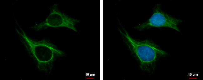 CKAP2 Antibody in Immunocytochemistry (ICC/IF)