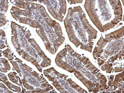 DOK6 Antibody in Immunohistochemistry (Paraffin) (IHC (P))