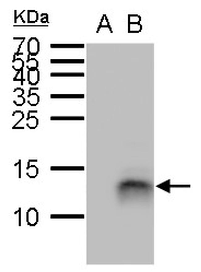 PI3 Antibody in Western Blot (WB)