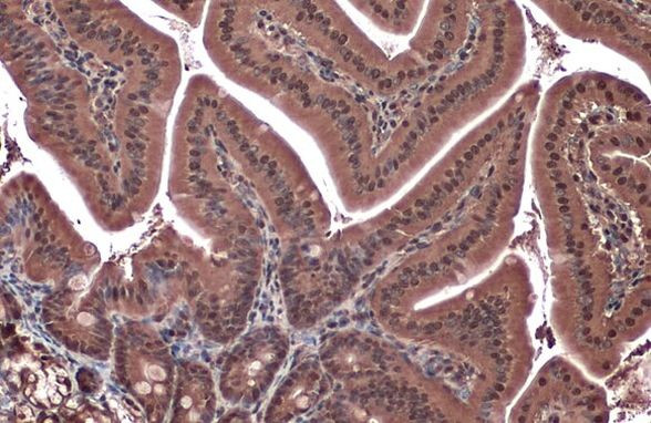 Phospho-eNOS (Ser1177) Antibody in Immunohistochemistry (Paraffin) (IHC (P))
