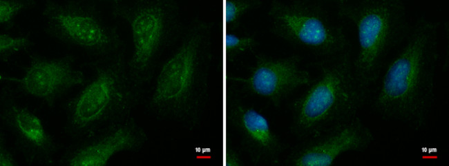 EXOC8 Antibody in Immunocytochemistry (ICC/IF)