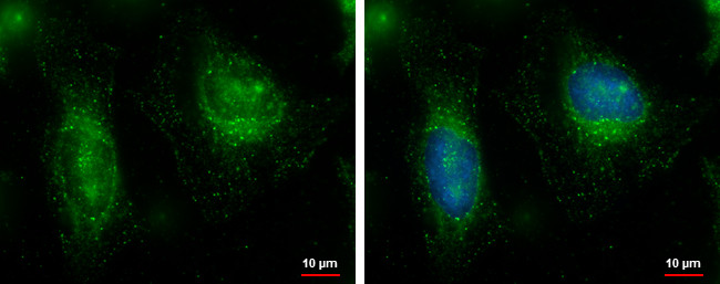 FAM21C Antibody in Immunocytochemistry (ICC/IF)