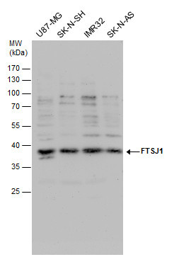 FTSJ1 Antibody in Western Blot (WB)