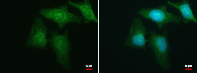 HBS1L Antibody in Immunocytochemistry (ICC/IF)