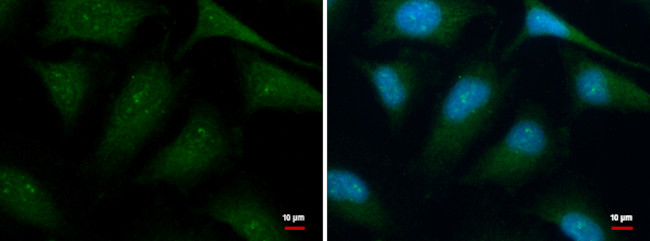 HBS1L Antibody in Immunocytochemistry (ICC/IF)