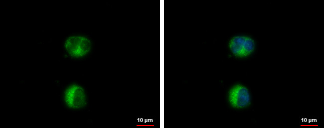 HEATR2 Antibody in Immunocytochemistry (ICC/IF)