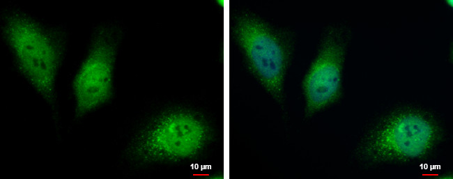 HKDC1 Antibody in Immunocytochemistry (ICC/IF)