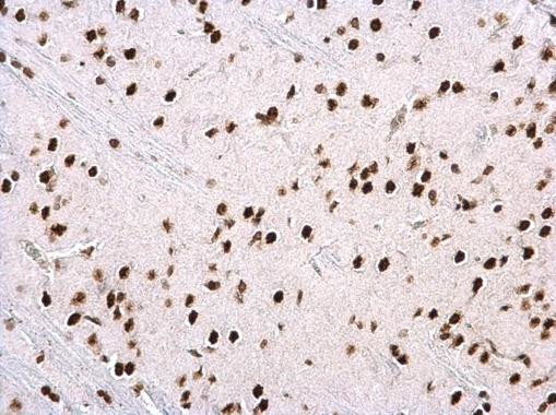 hnRNP H2 Antibody in Immunohistochemistry (Paraffin) (IHC (P))