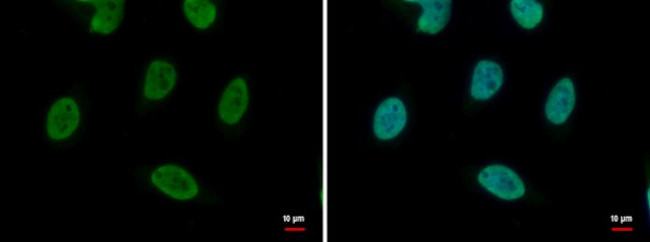hnRNP DL Antibody in Immunocytochemistry (ICC/IF)