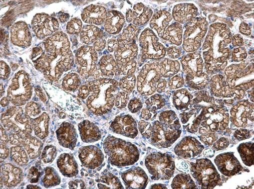 ITGB6 Antibody in Immunohistochemistry (Paraffin) (IHC (P))