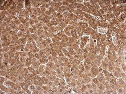 KCTD9 Antibody in Immunohistochemistry (Paraffin) (IHC (P))