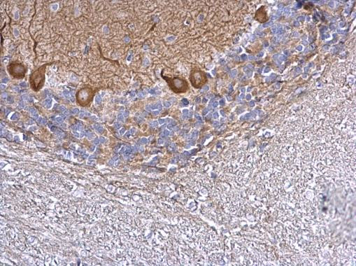 CAZIP Antibody in Immunohistochemistry (Paraffin) (IHC (P))