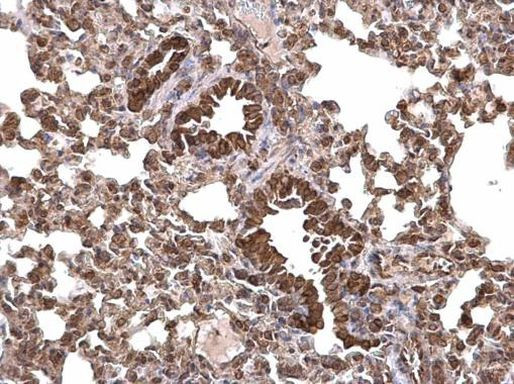 LRRC8D Antibody in Immunohistochemistry (Paraffin) (IHC (P))