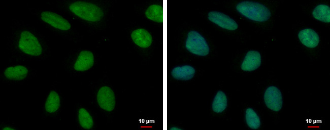 MCM6 Antibody in Immunocytochemistry (ICC/IF)
