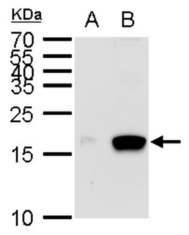 MIA Antibody in Western Blot (WB)