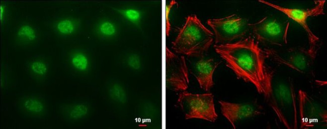 MTF2 Antibody in Immunocytochemistry (ICC/IF)
