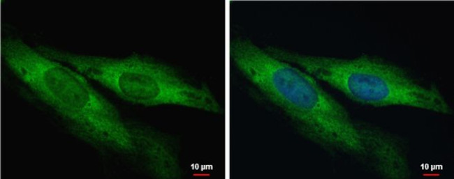 MTO1 Antibody in Immunocytochemistry (ICC/IF)