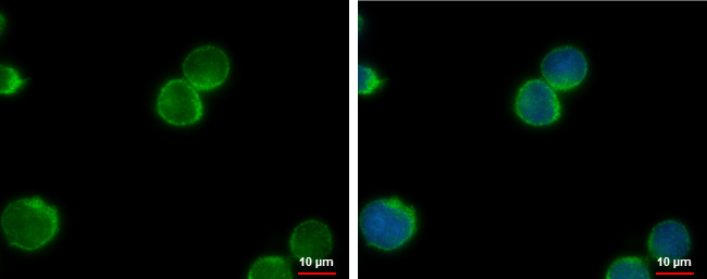 NEK1 Antibody in Immunocytochemistry (ICC/IF)