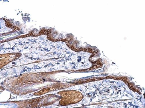 PCDHB1 Antibody in Immunohistochemistry (Paraffin) (IHC (P))