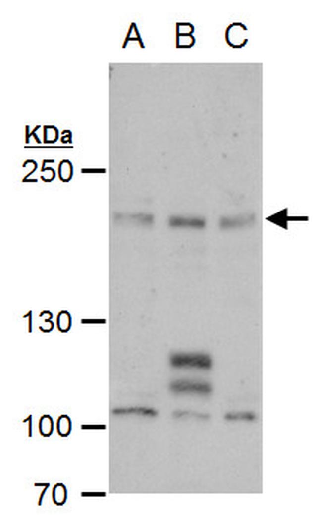 PCF11 Antibody in Western Blot (WB)