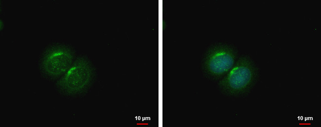 PCOLCE2 Antibody in Immunocytochemistry (ICC/IF)