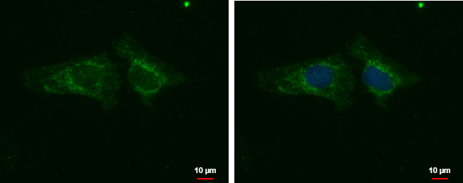 PHACTR1 Antibody in Immunocytochemistry (ICC/IF)