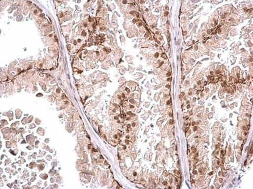 POLR2D Antibody in Immunohistochemistry (Paraffin) (IHC (P))