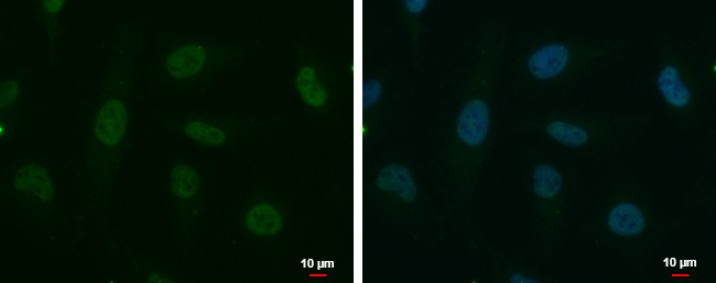 POLR2D Antibody in Immunocytochemistry (ICC/IF)