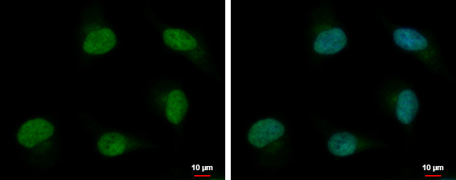 PSPC1 Antibody in Immunocytochemistry (ICC/IF)