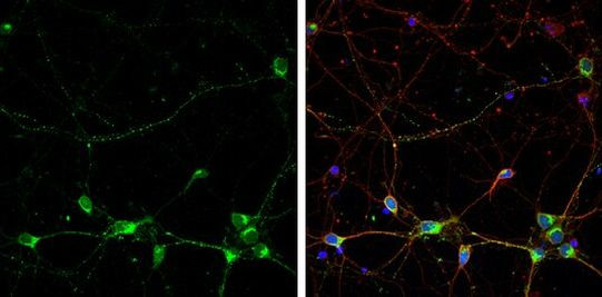 RPH3A Antibody in Immunocytochemistry (ICC/IF)
