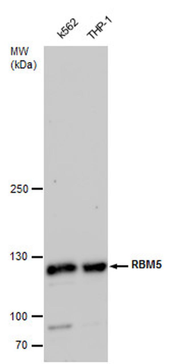 RBM5 Antibody in Western Blot (WB)