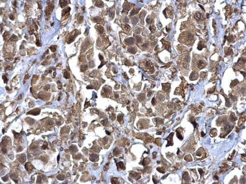 RERG Antibody in Immunohistochemistry (Paraffin) (IHC (P))
