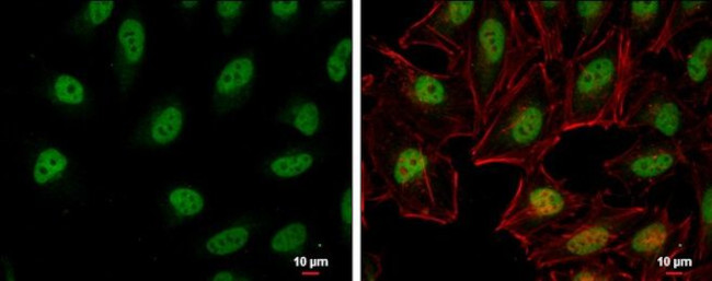 RFC1 Antibody in Immunocytochemistry (ICC/IF)