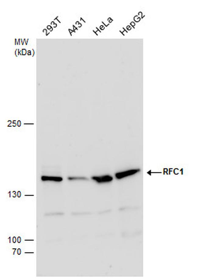 RFC1 Antibody in Western Blot (WB)