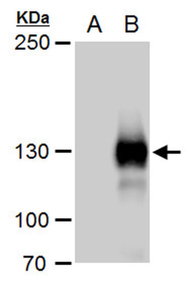 Rubicon Antibody in Western Blot (WB)