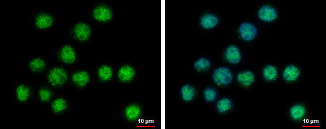 SERTAD2 Antibody in Immunocytochemistry (ICC/IF)