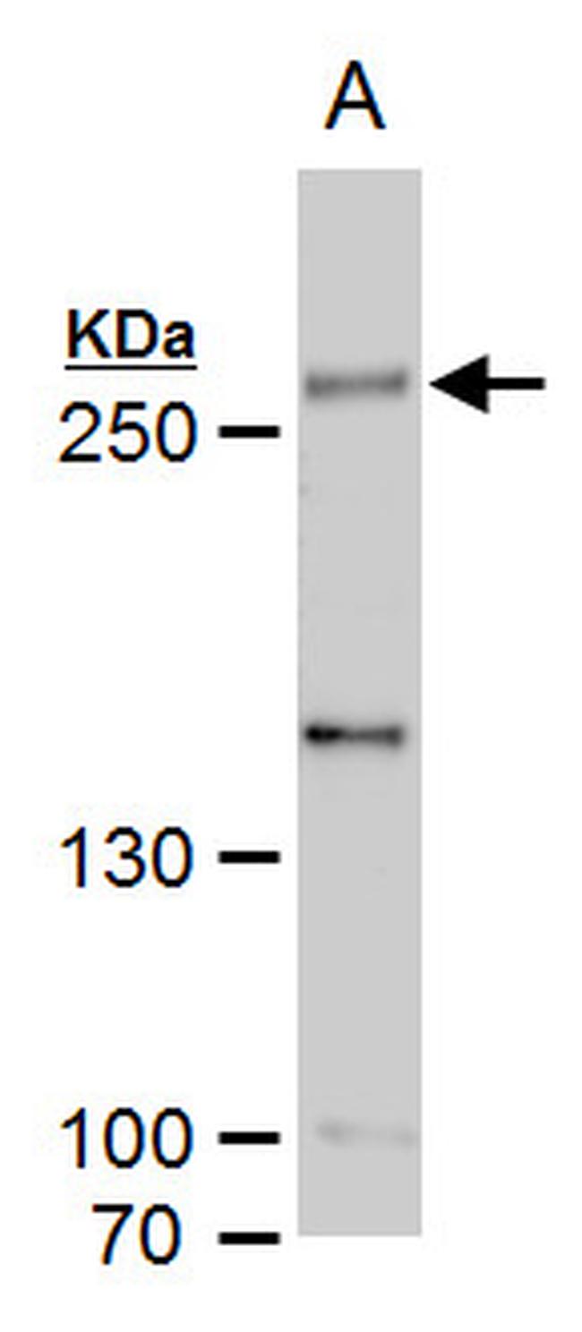 SETD1A Antibody in Western Blot (WB)