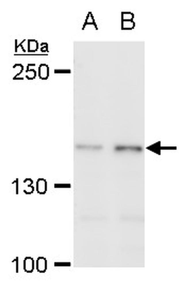 SUGP2 Antibody in Western Blot (WB)
