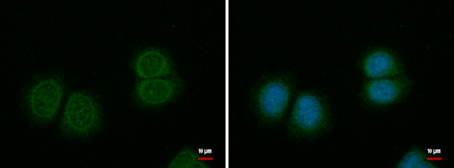 SPINK1 Antibody in Immunocytochemistry (ICC/IF)