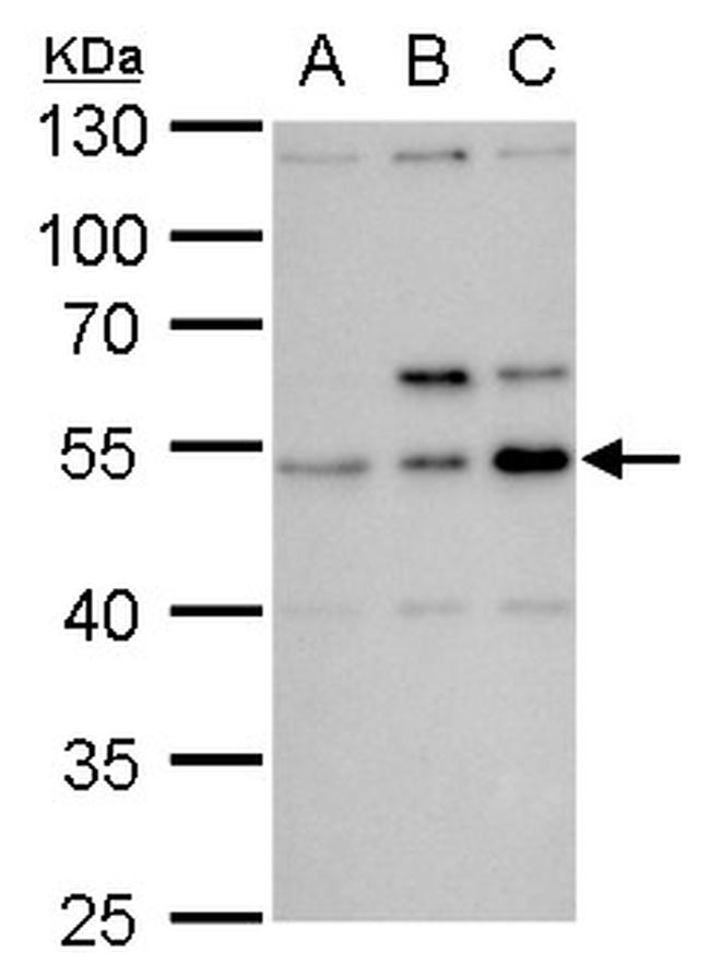 SS18 Antibody in Western Blot (WB)