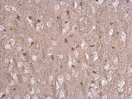 STRC Antibody in Immunohistochemistry (Paraffin) (IHC (P))
