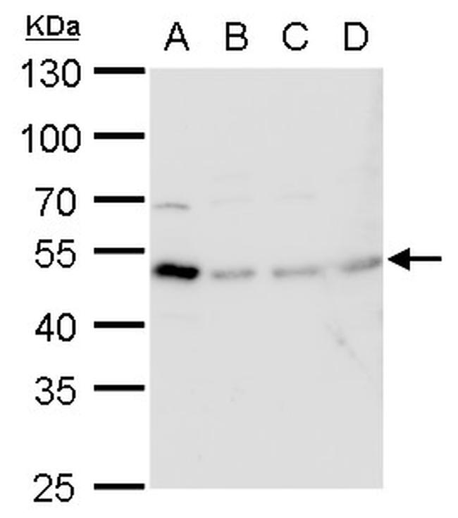 TIPIN Antibody in Western Blot (WB)