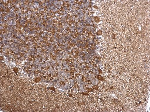 TRAPPC2L Antibody in Immunohistochemistry (Paraffin) (IHC (P))