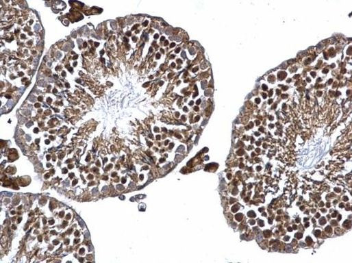 TRIM16 Antibody in Immunohistochemistry (Paraffin) (IHC (P))