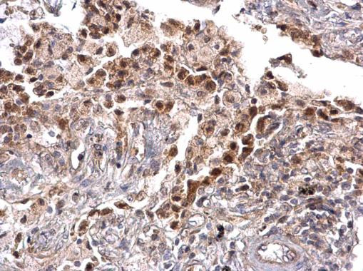 TRPS1 Antibody in Immunohistochemistry (Paraffin) (IHC (P))