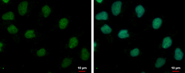 TRUB1 Antibody in Immunocytochemistry (ICC/IF)