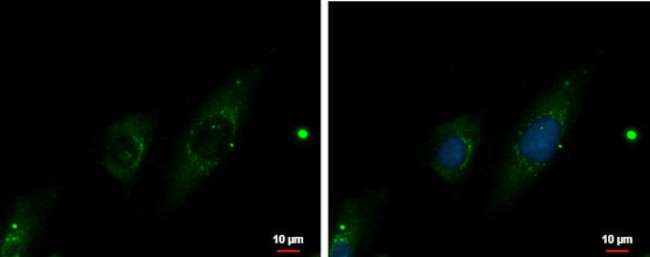 ATP6V1G2 Antibody in Immunocytochemistry (ICC/IF)
