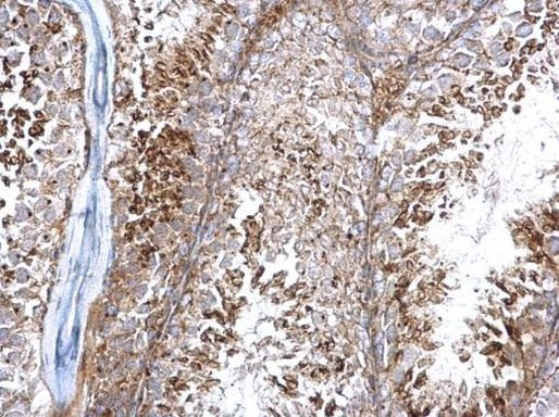 WDR44 Antibody in Immunohistochemistry (Paraffin) (IHC (P))
