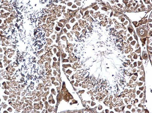 GPN1 Antibody in Immunohistochemistry (Paraffin) (IHC (P))