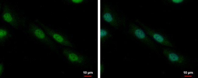 ZFP82 Antibody in Immunocytochemistry (ICC/IF)